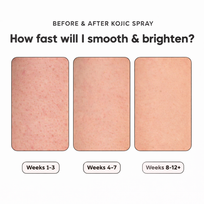 Kojic & Turmeric Body Spray