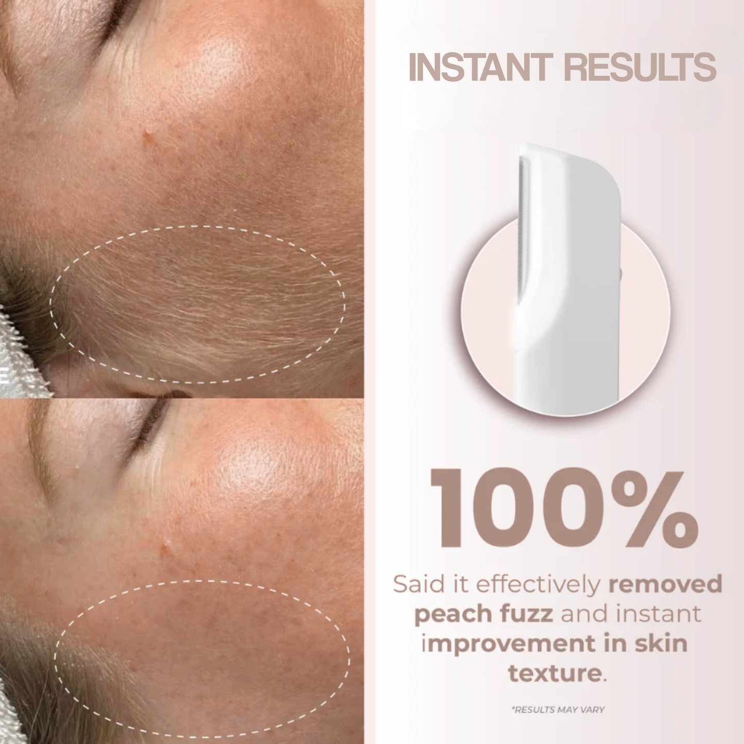 Dermaplaning Facial Tool